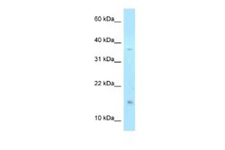 TSSC3 Rabbit anti-Human, Polyclonal, Novus Biologicals 0.1ml; Unconjugated:Antibodies,